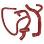 Arlows Nebenschlauchkit Silikon Renault 1.8L / 2.0L 16V ( Rot )